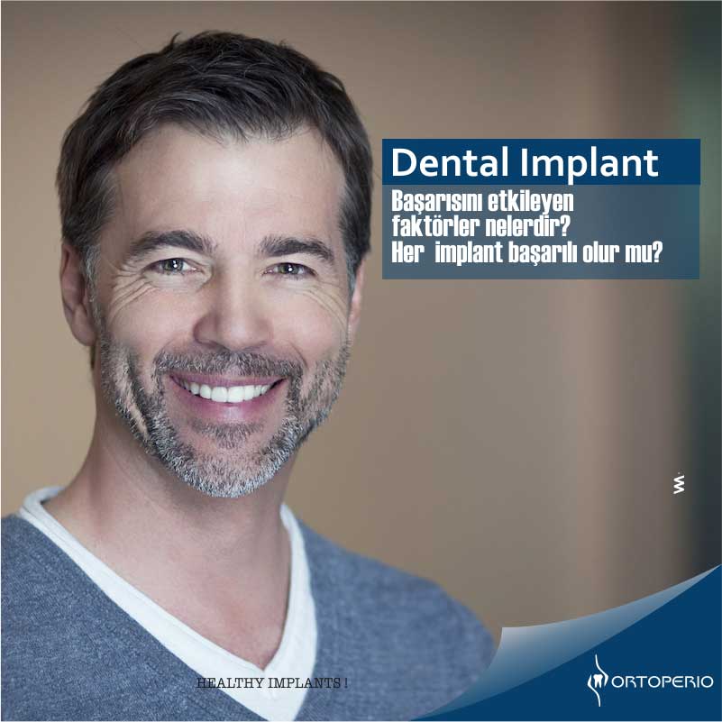 Dental implant başarısını etkileyen faktörler nelerdir? Her  implant başarılı olur mu?